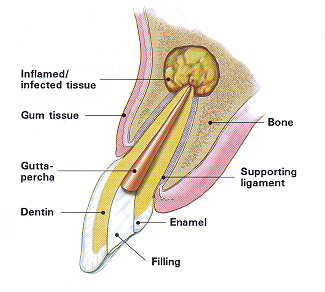tooth-image